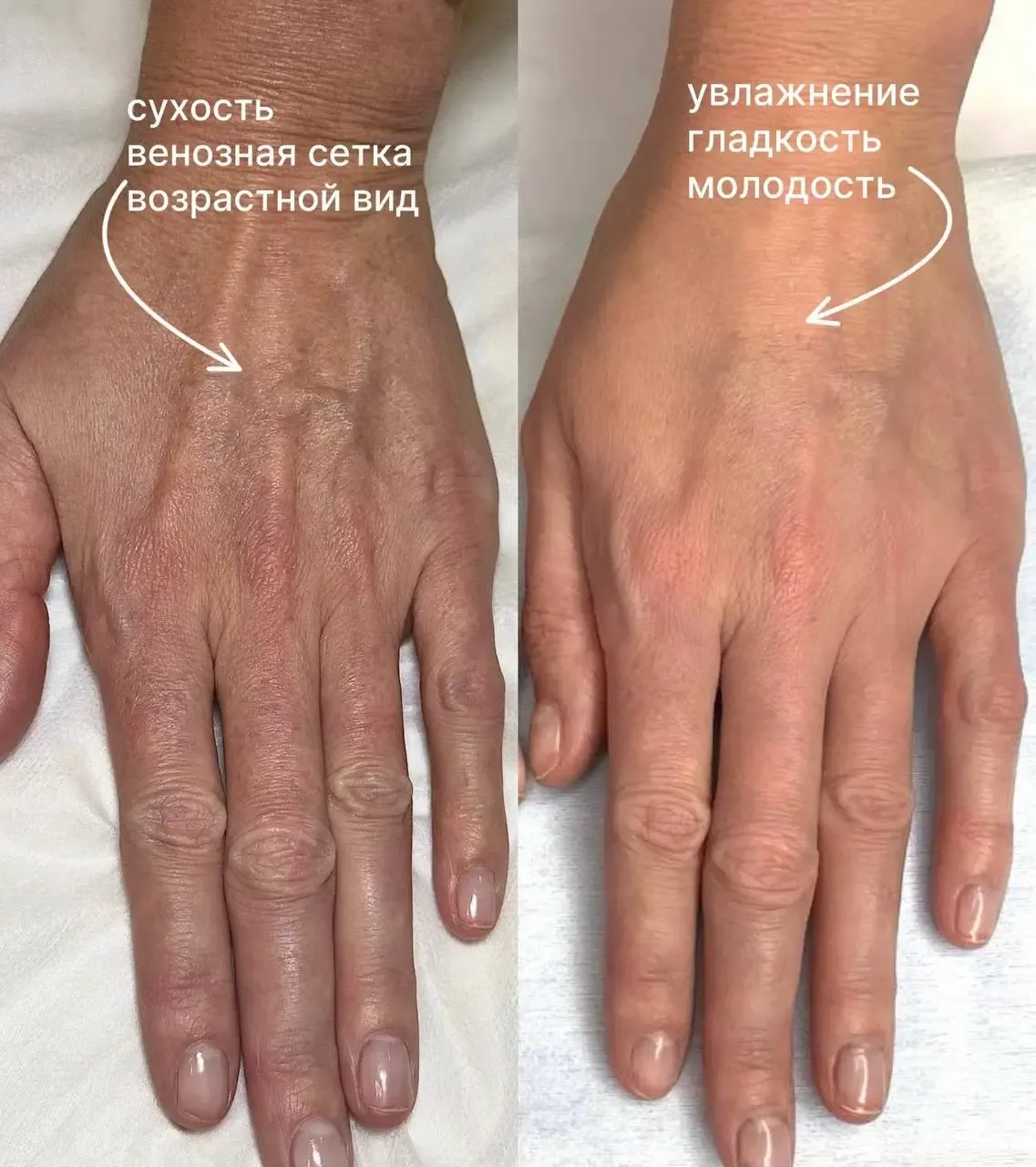 Борцова