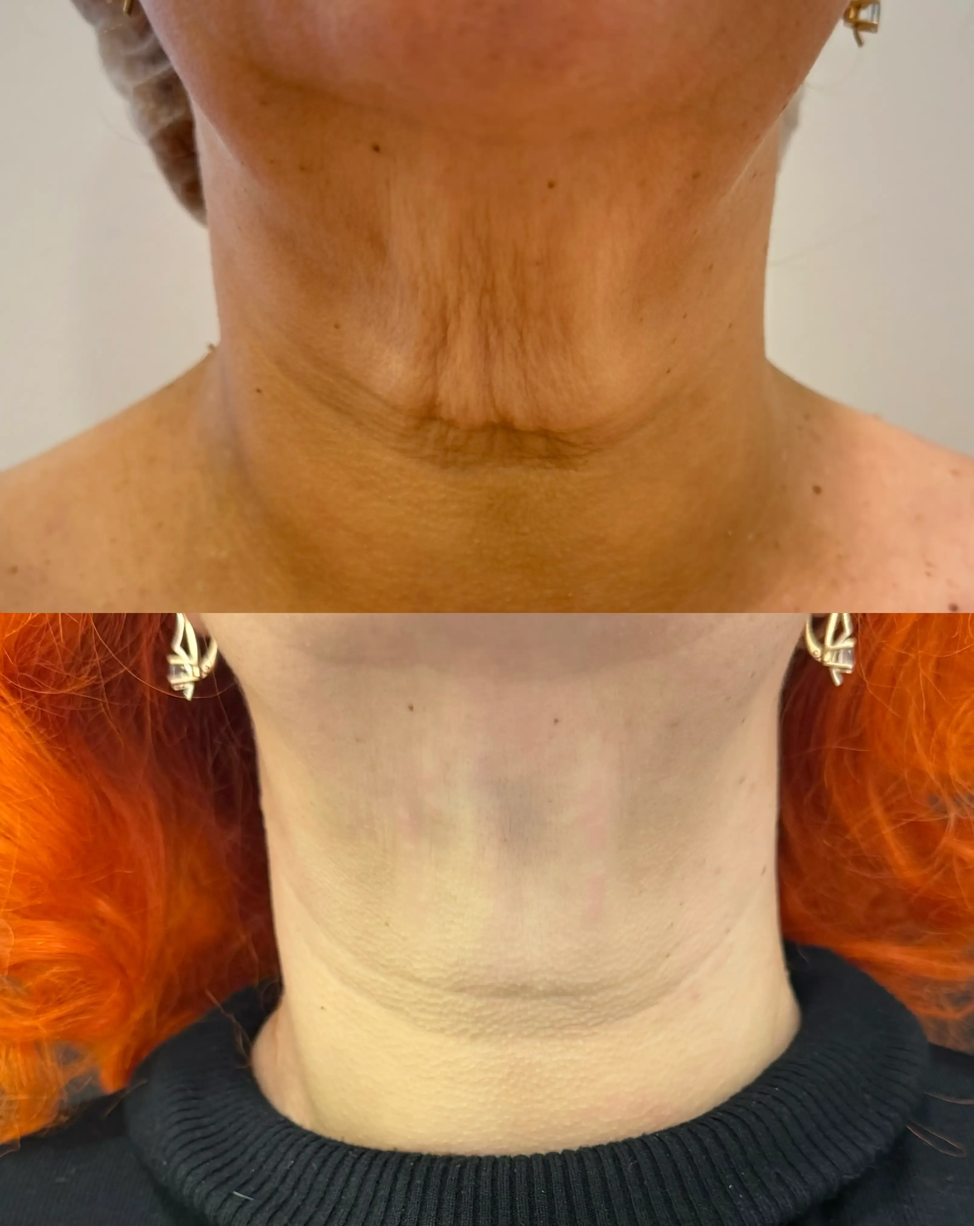 Зуйкова